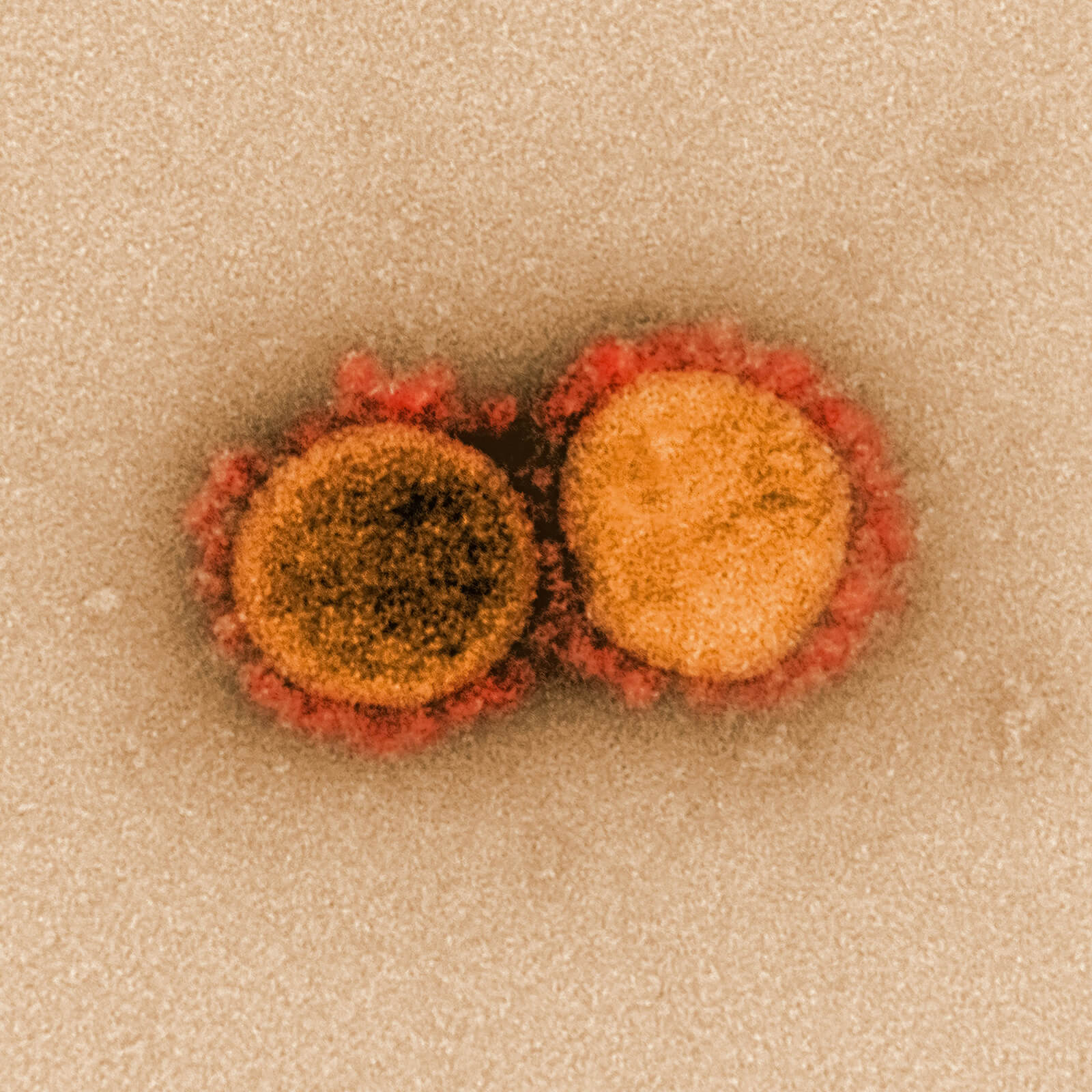 A Functional Medicine Approach to Biofilms: Understanding Their Role in Chronic Infections and How to Treat Them