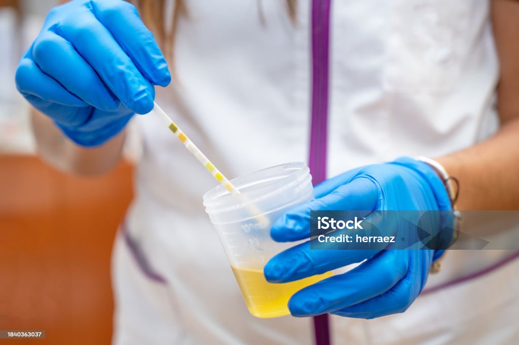 DUTCH Hormone Test: A Functional Medicine Approach to Hormone Imbalance in Australia