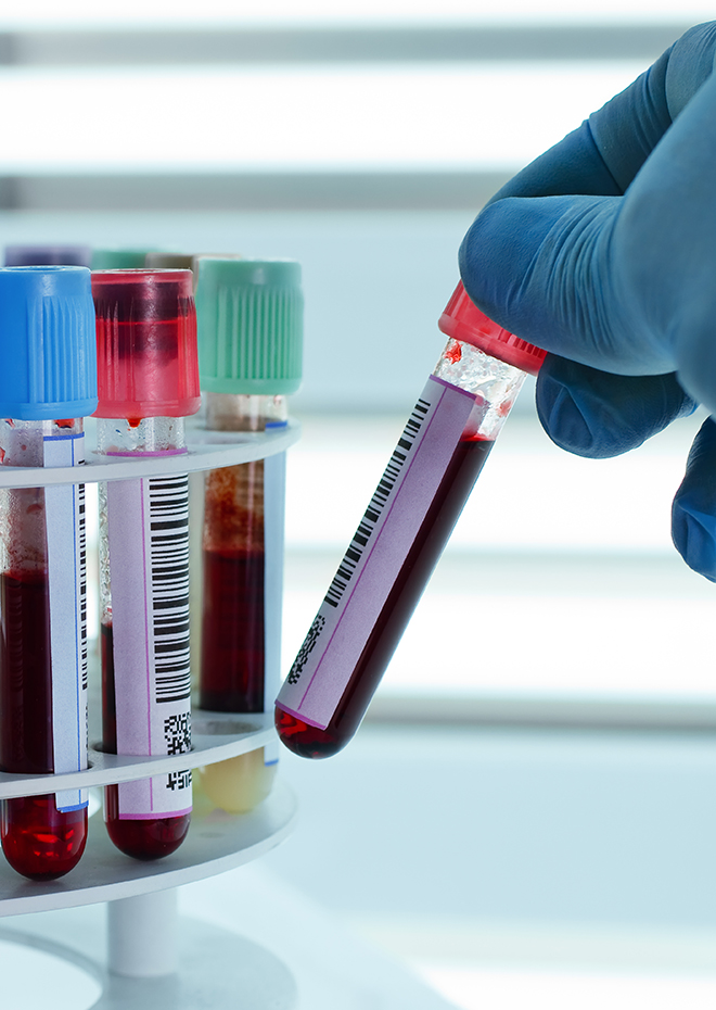 Functional Medicine Testing Australia Essential Functional Medicine testing Australia