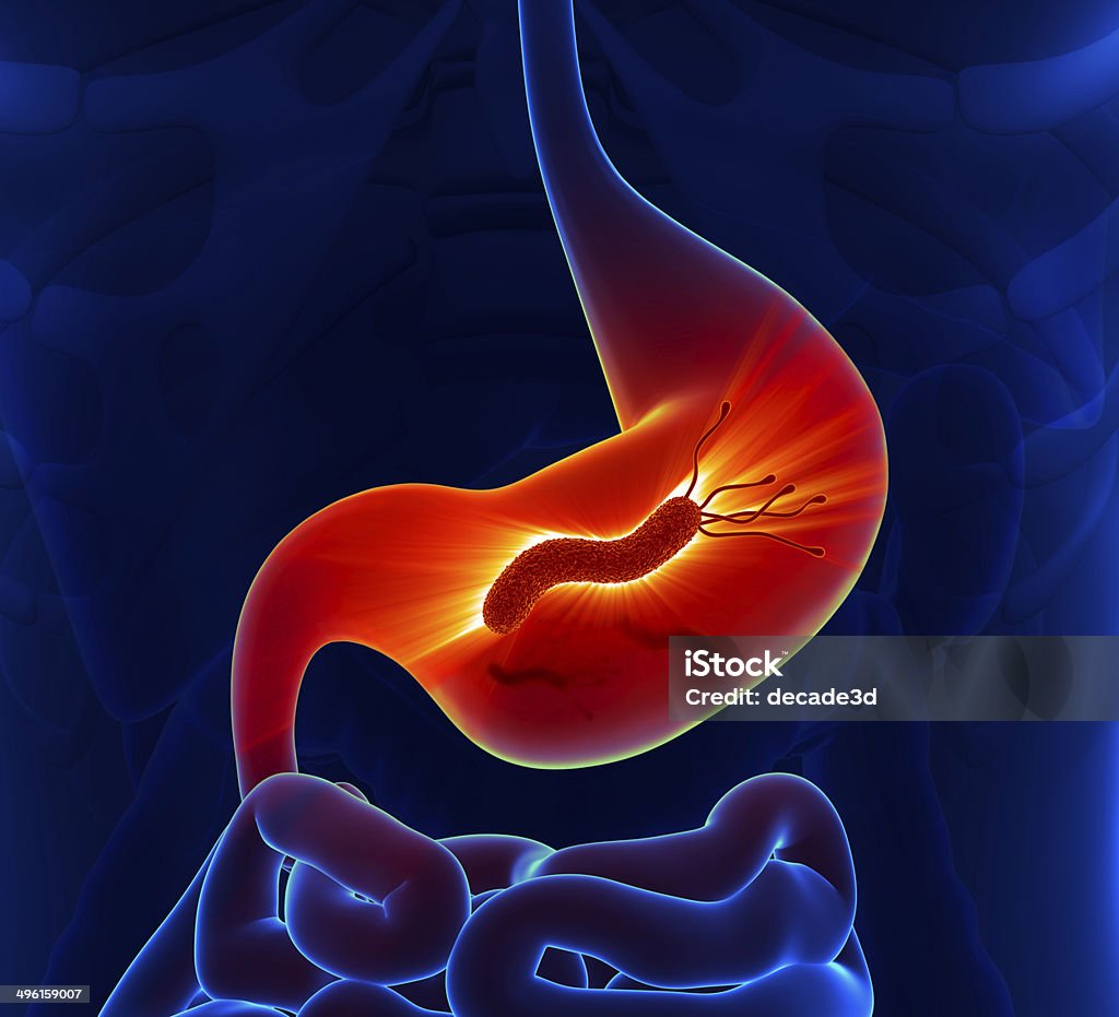 H. Pylori: A Functional Medicine Approach to Treating Gut Infections and Restoring Digestive Health